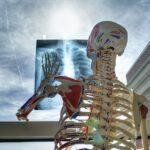 Welt-Osteoporose-Tag