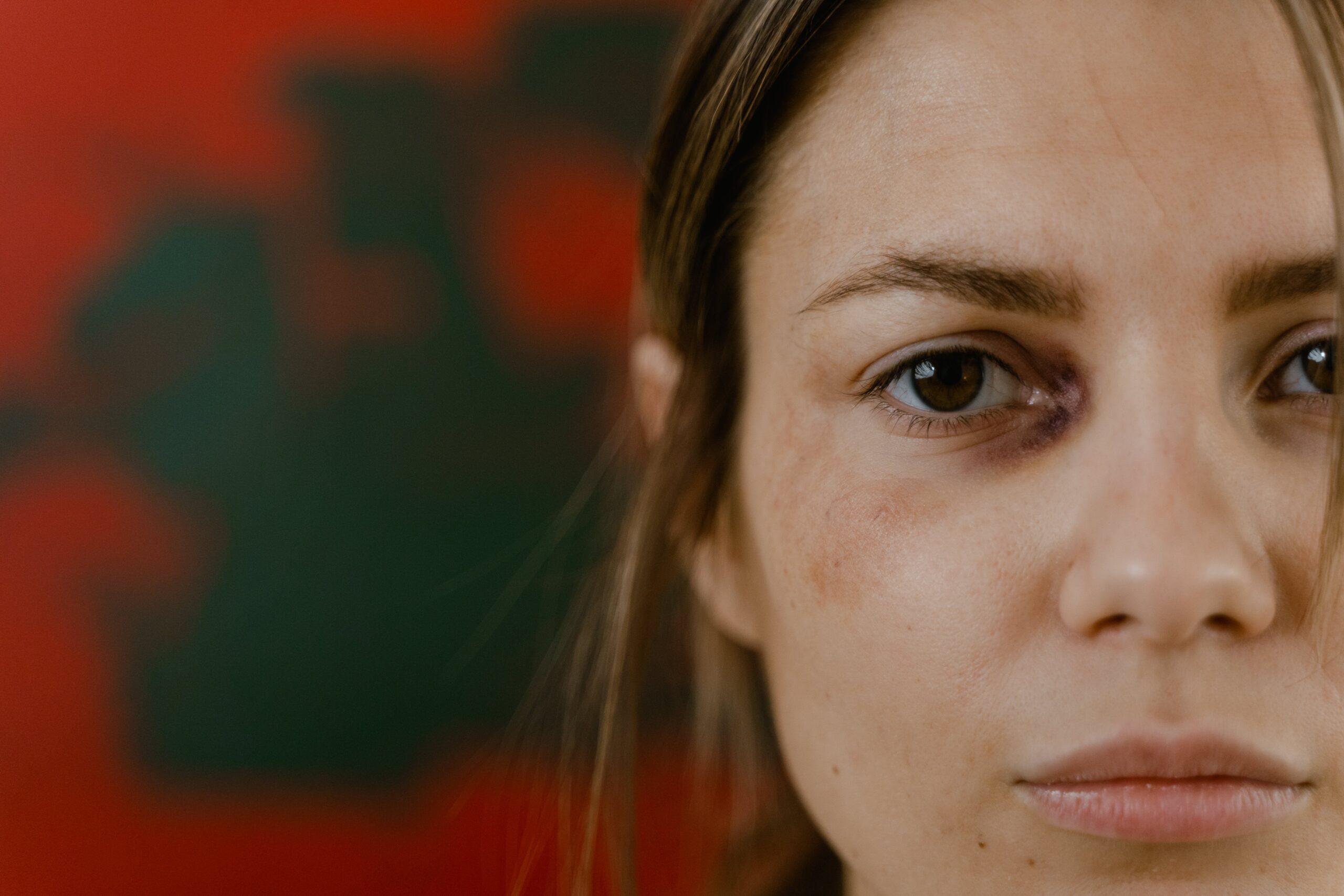 Internationaler Tag zur Beseitigung von Gewalt gegen Frauen