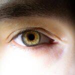 Iris-Heterochromie-Tag